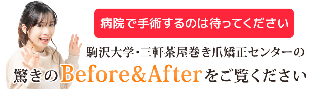驚きのBefore&Afterをご覧ください