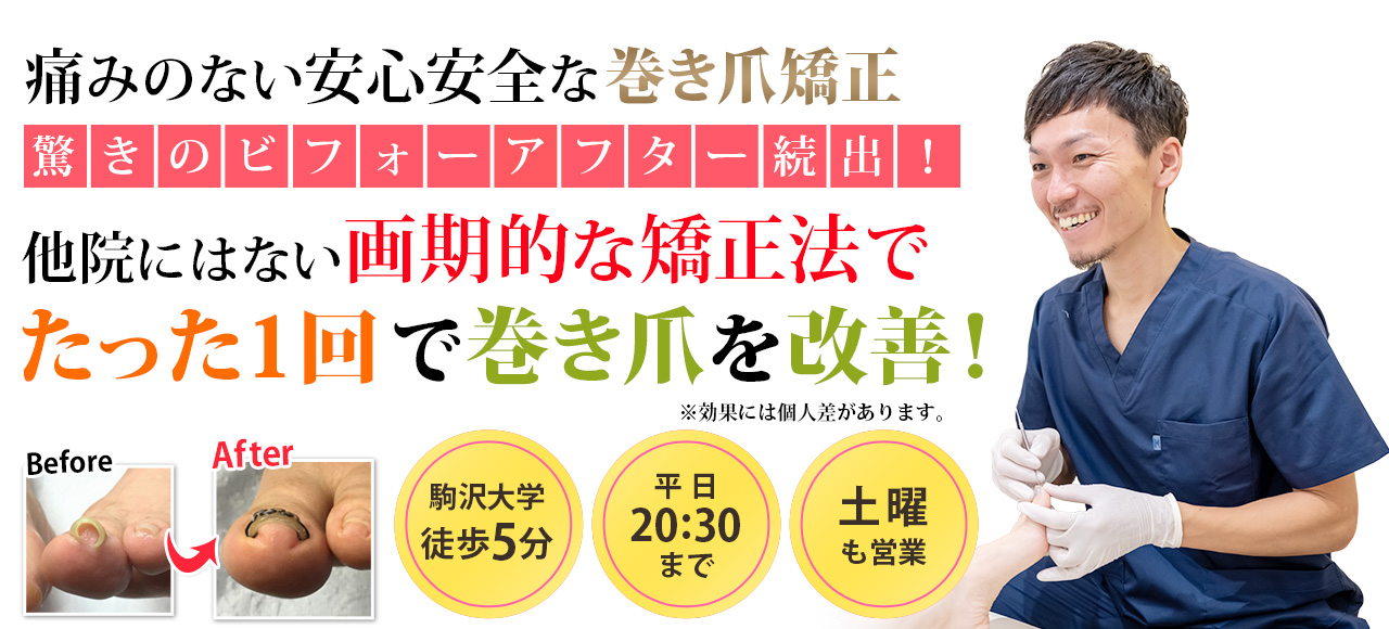 駒沢大学徒歩5分 駒沢大学・三軒茶屋巻き爪矯正センター